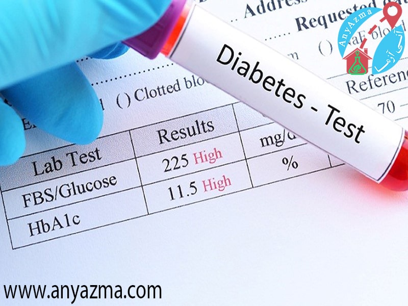 استفاده از نمونه خون برای تشخیص دیابت
