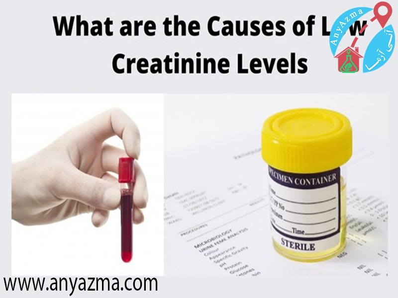 creatinine چیست | كراتينين پايين در خون و ادرار