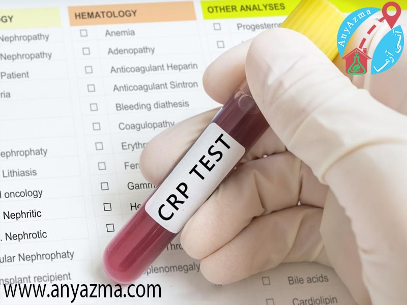 تشخیص سطح crp در آزمایش خون
