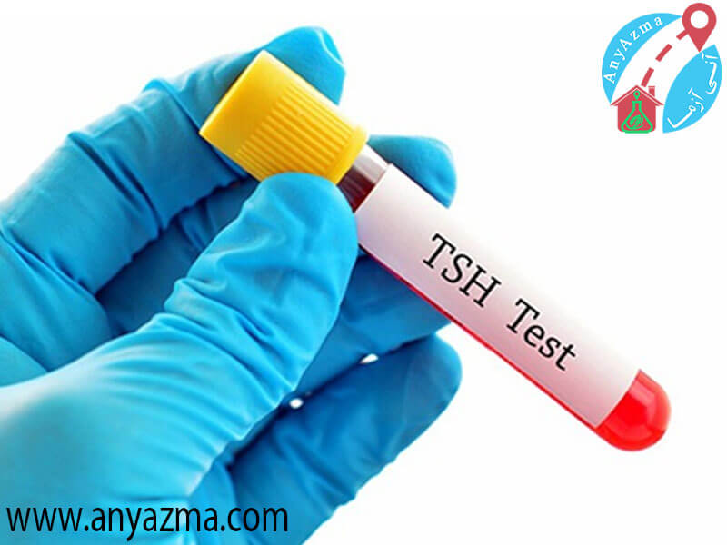 tsh در آزمایش خون چیست