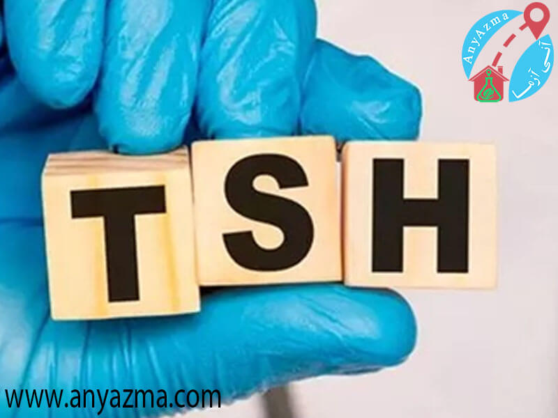 tsh در آزمایش خون چیست و بررسی تاثیر آن بر هورمون های Fsh و Ft4