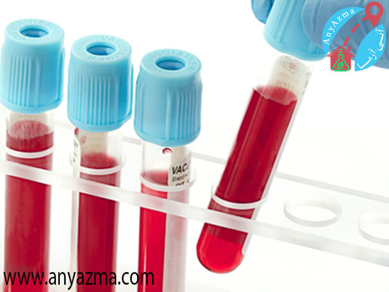 آزمایش ادرار و خون برای مقابله با بیماری