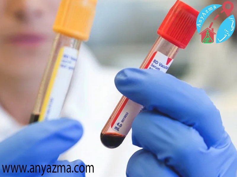 موارد مهم در تفسیر آزمایش خون