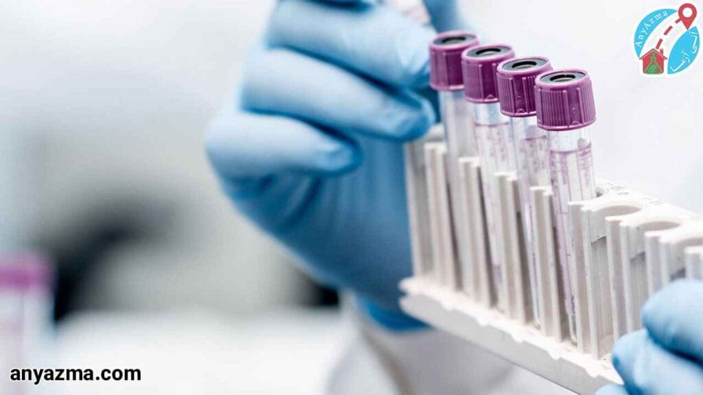 آزمایش تعیین رابطه ابوت