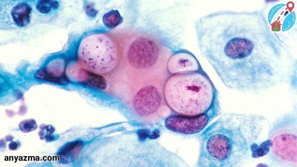 بررسی بیماری های مختلف از طریق آزمایش STD