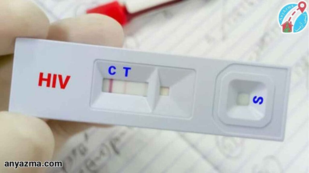 تشخیص بیماری های HIV از طریق آزمایش STD