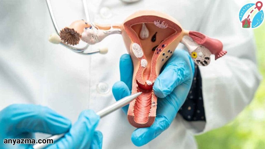 نتایج غیرطبیعی در آزمایش پاپ اسمیر