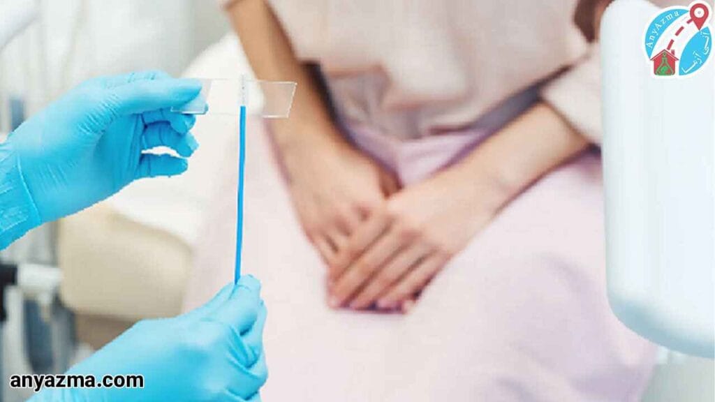 چه کسانی باید آزمایش پاپ اسمیر انجام دهند