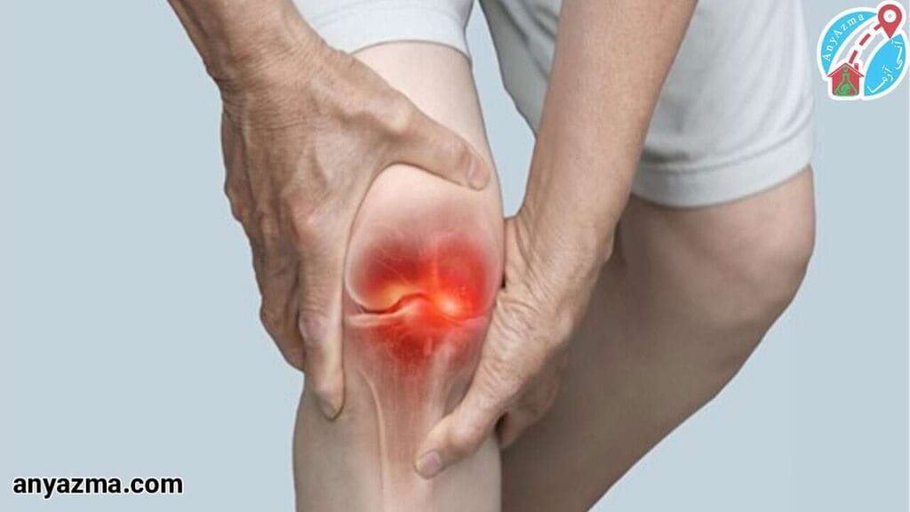 چکاپ روماتیسم زانو