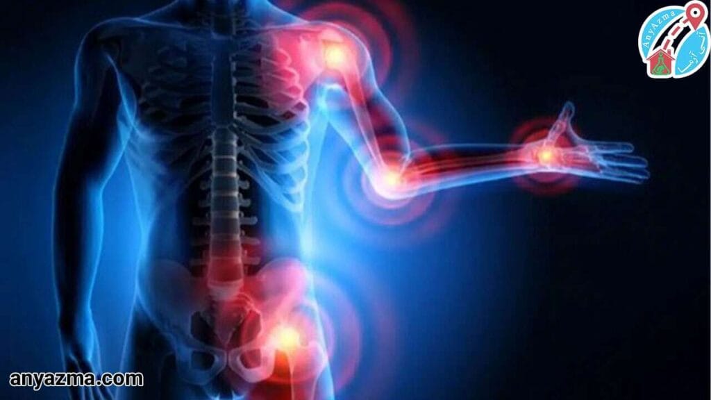 چکاپ ویژه روماتیسم