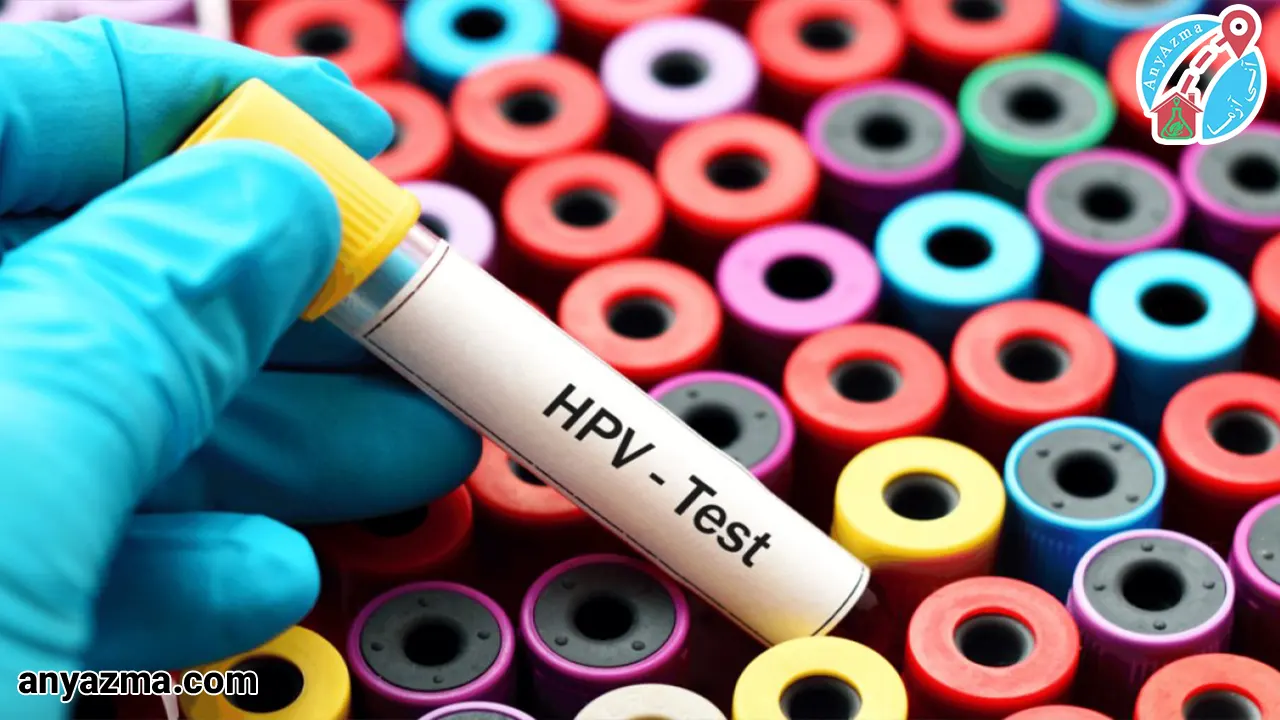 آزمایشhpv