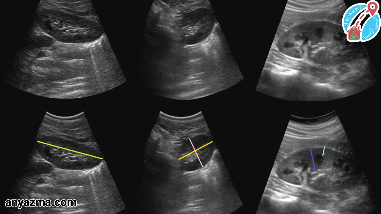 آمادگی قیل از سونوگرافی