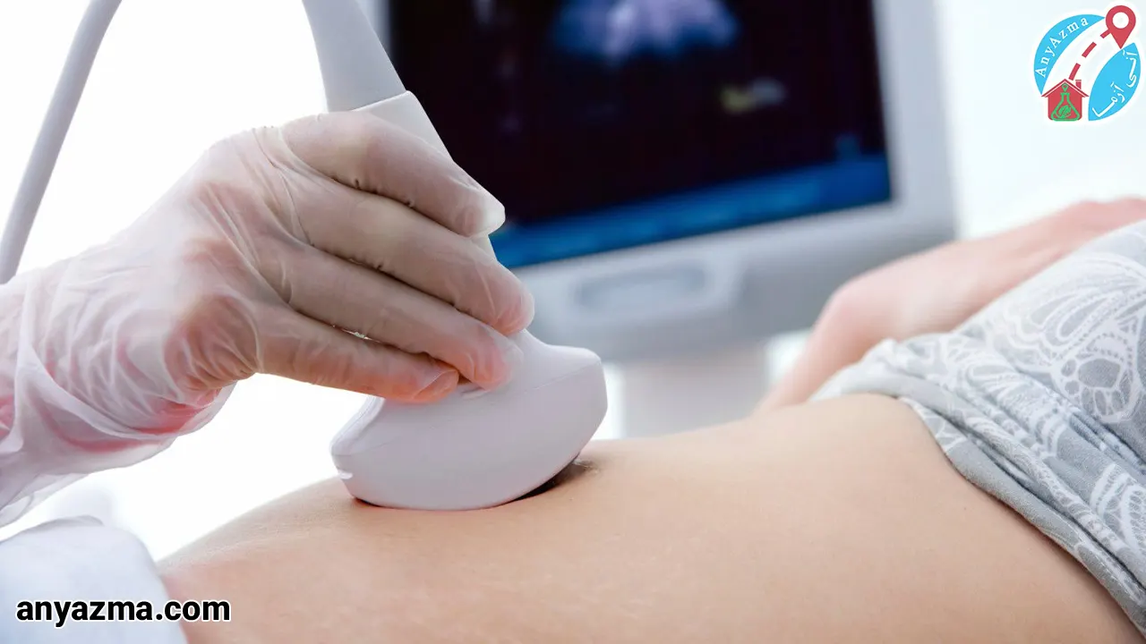 کاربرد های سونوگرافی