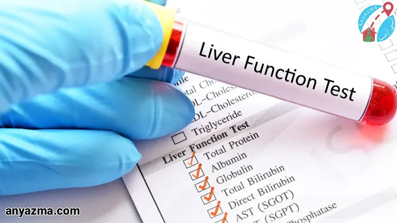 آزمایش چکاپ کبد در منزل