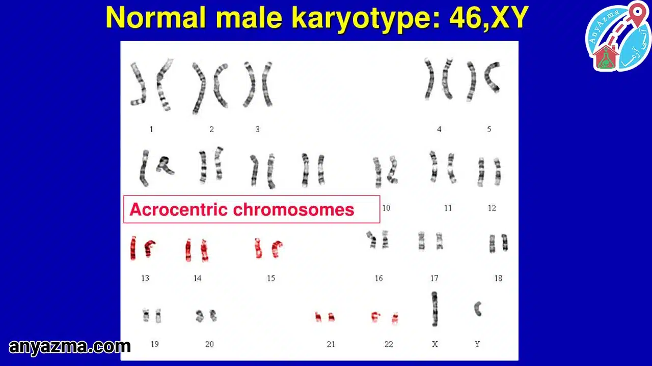 آزمایش کاریوتایپ در منزل
