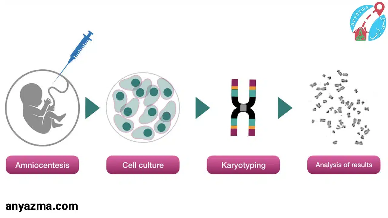 آزمایش کاریوتایپ در منزل
