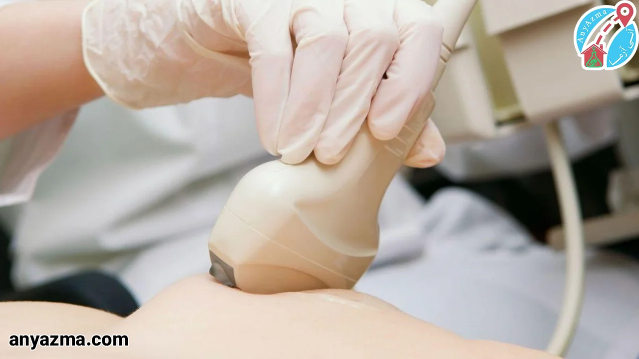 تشخیص سرطان سینه با سونوگرافی