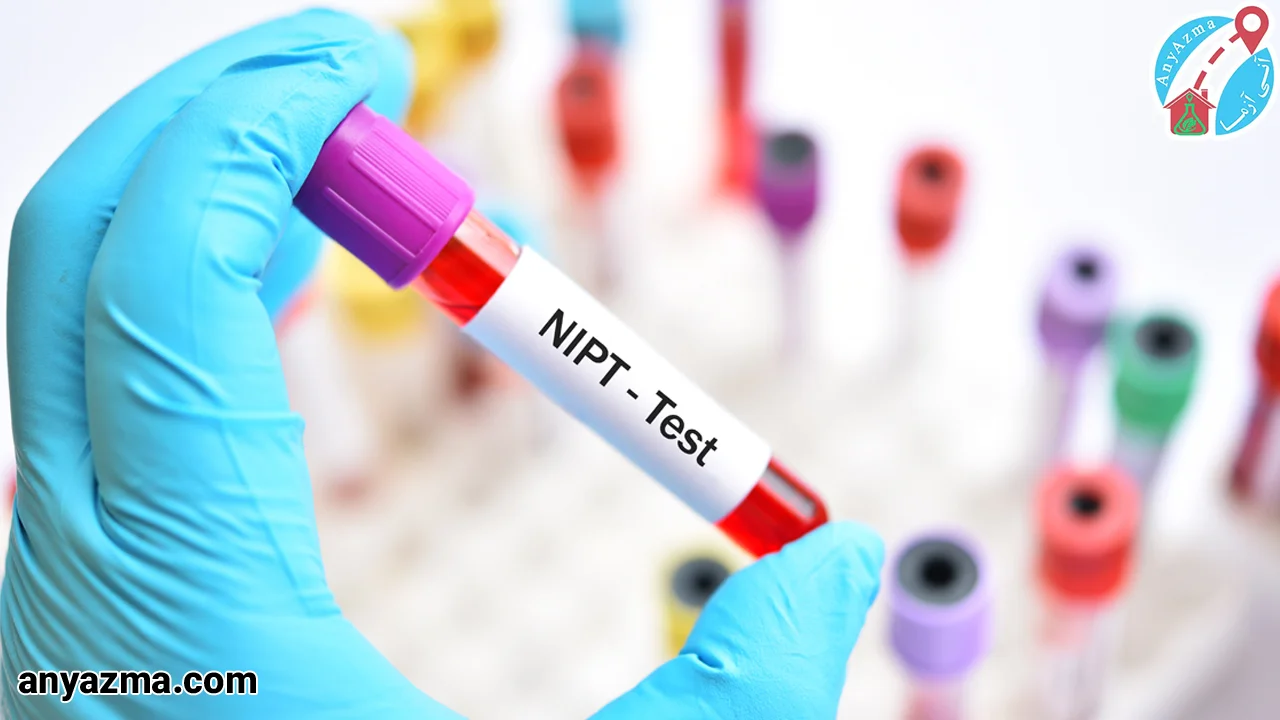 آزمایش nipt در منزل