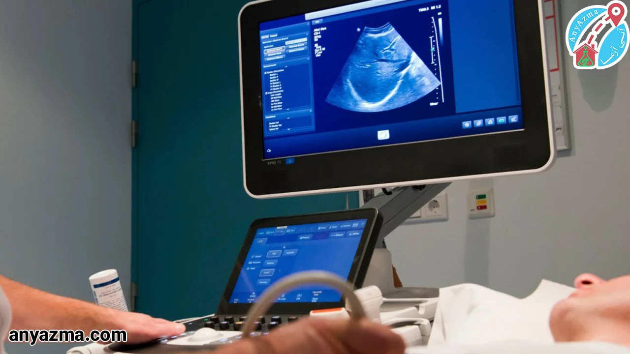 سونوگرافی داپلر یک آزمایش غیر تهاجمی است.