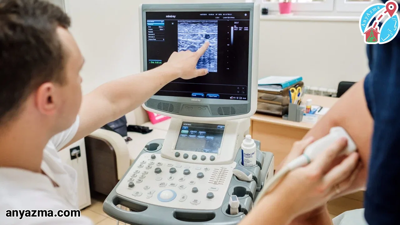 سونوگرافی داپلر تک اندام