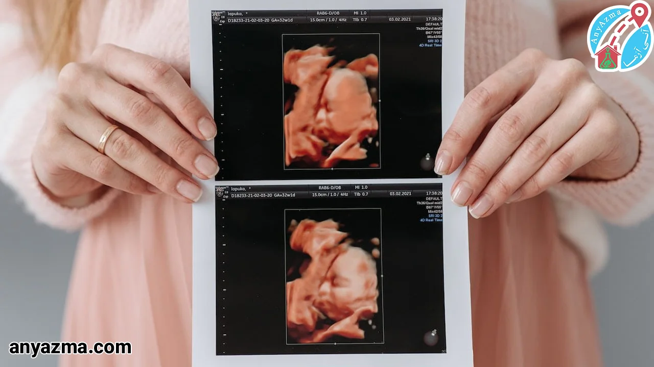 اشتباه سونوگرافی در تشخیص جنسیت جنین دختر و پسر