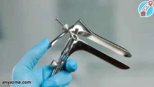 قبل از آزمایش پاپ اسمیر چه نکاتی را رعایت کنیم؟