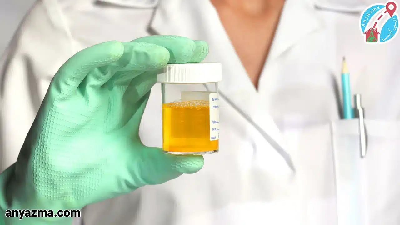 آزمایش ادرار در منزل