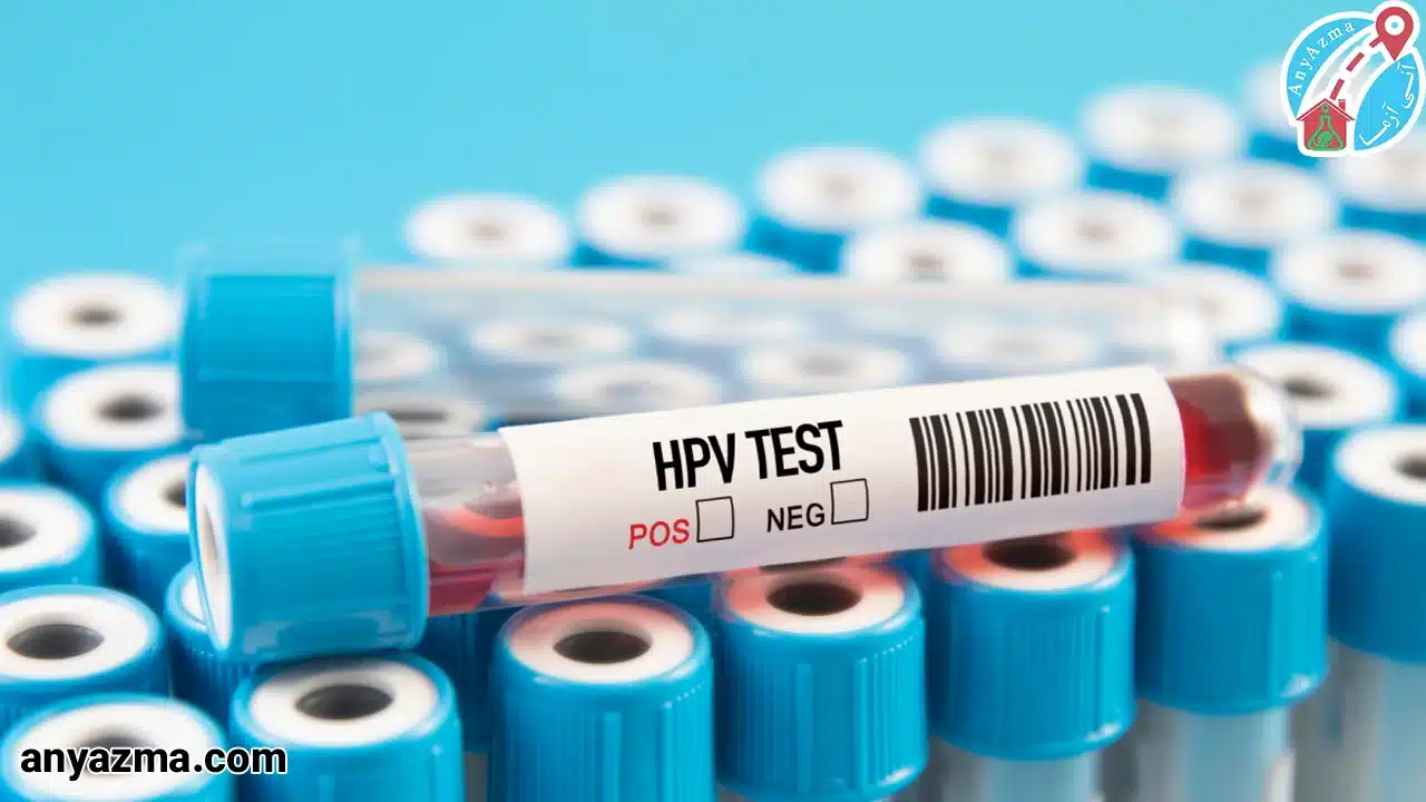 آزمایش عفونت های ویروسی