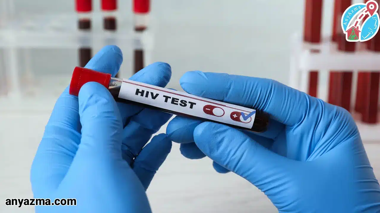 آزمایش عفونت های ویروسی