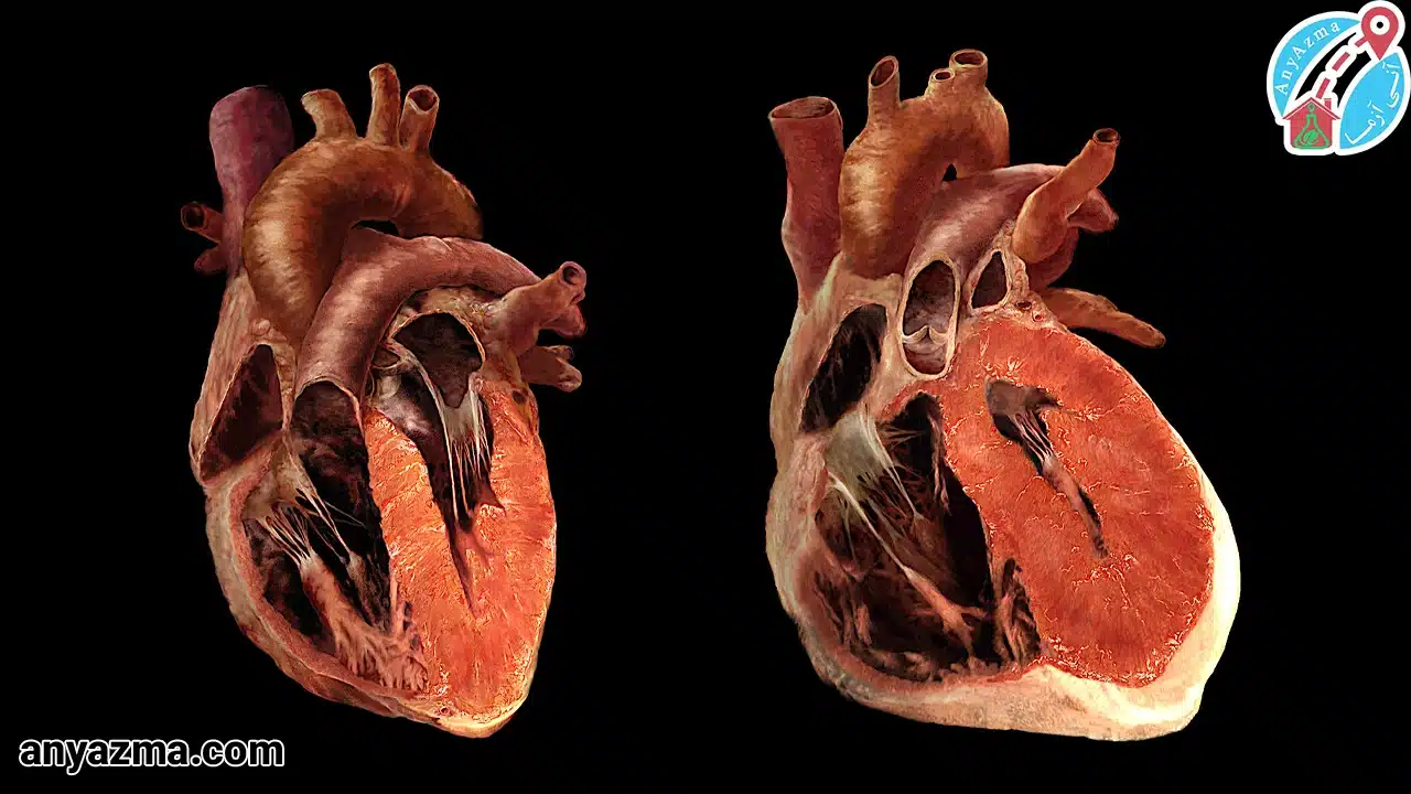 آیا بزرگ شدن قلب باعث مرگ میشود؟