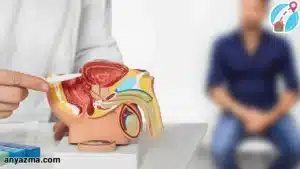 سونوگرافی پروستات