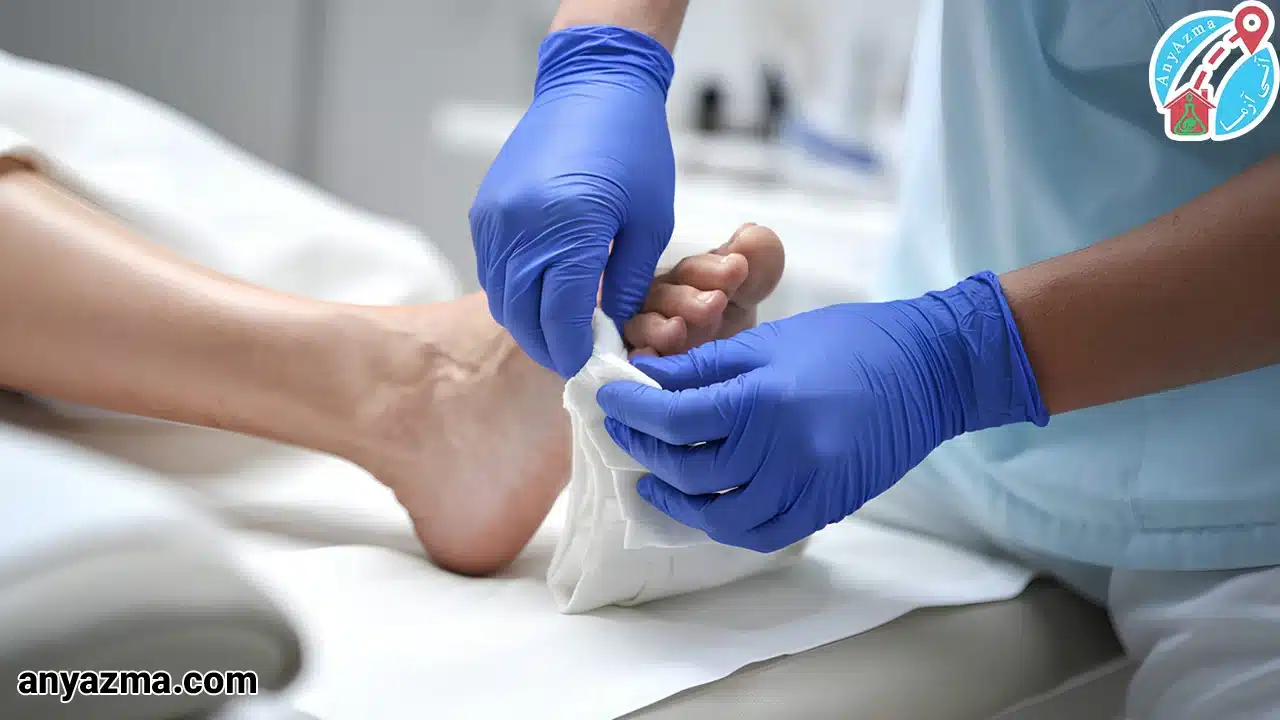 درمان زخم دیابتی در منزل 