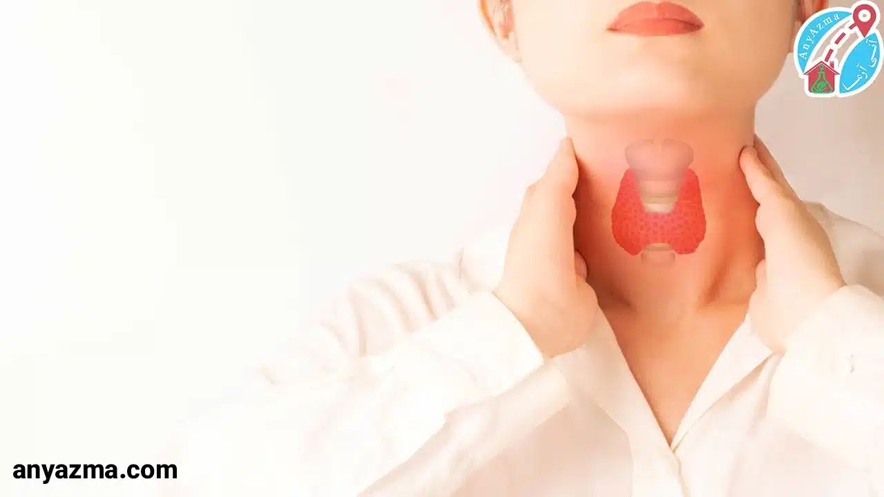 علت بوجود آمدن تیروئید پرکار