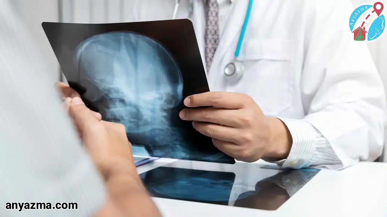 ویزیت متخصص مغز و اعصاب در منزل