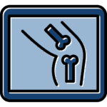 رادیولوژی زانو در منزل