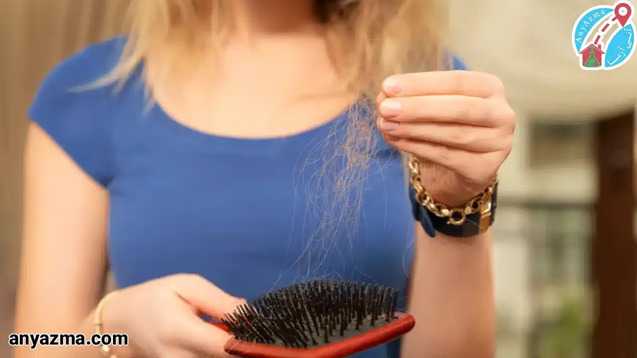 آیا کم کاری تیروئید باعث ریزش مو میشود؟