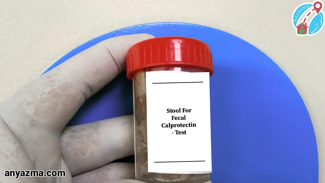  آزمایش مدفوع در منزل