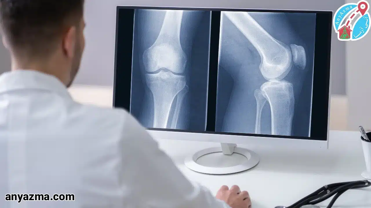 رادیولوژی زانو در منزل
