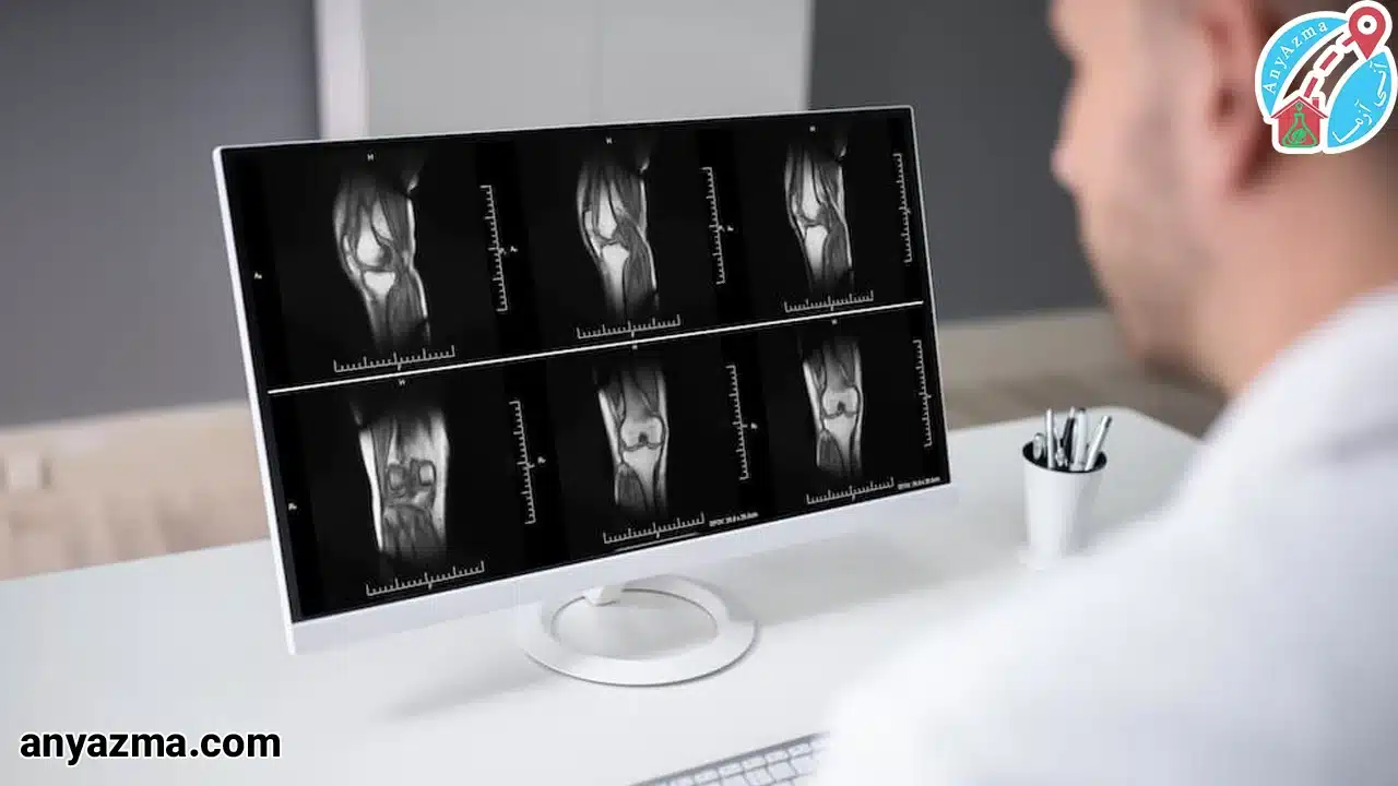 رادیولوژی زانو در منزل