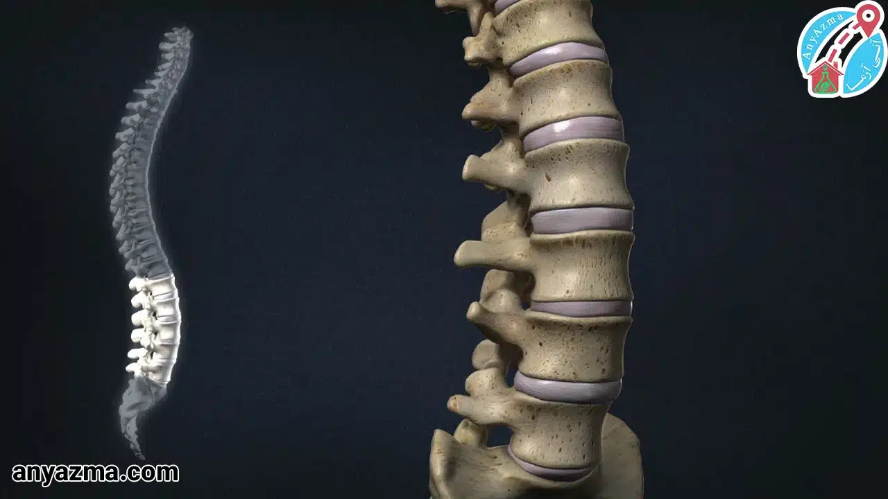 رادیولوژی ستون فقرات در منزل