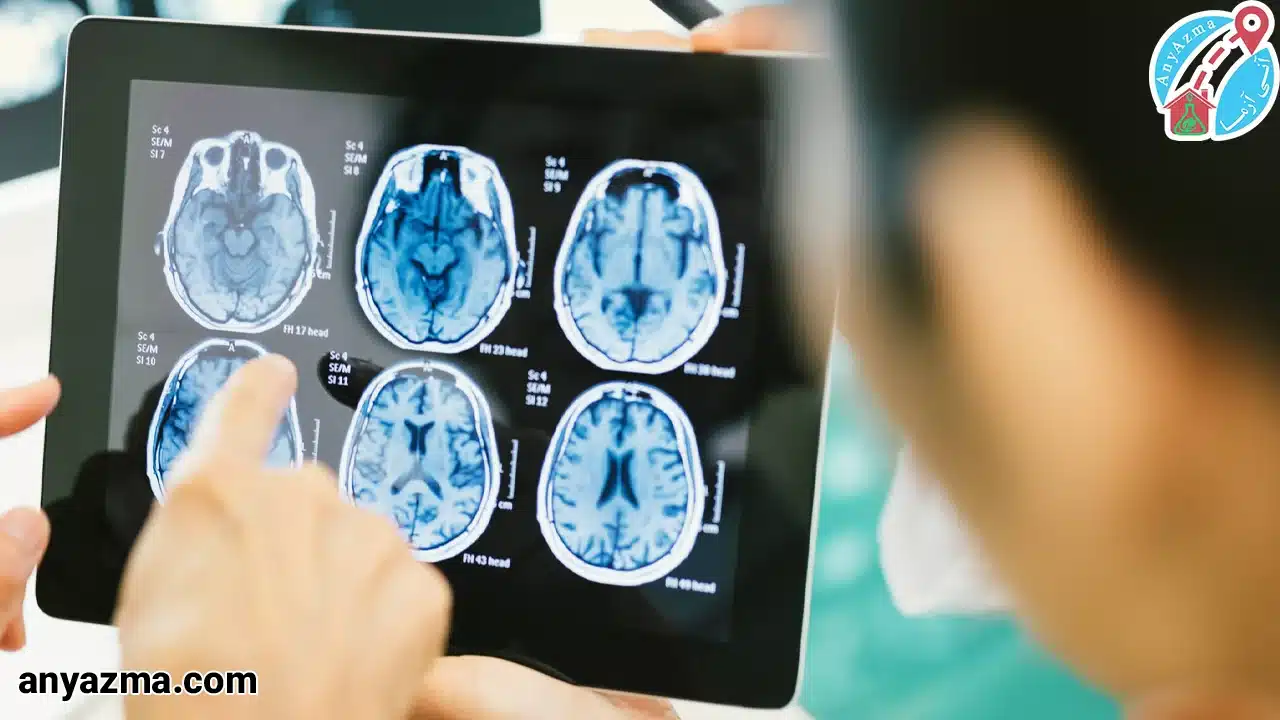 رادیولوژی سر در منزل