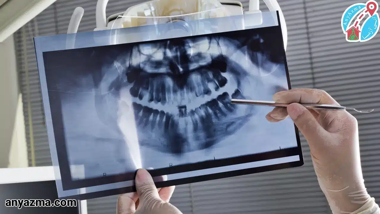 رادیولوژی فک و صورت در منزل