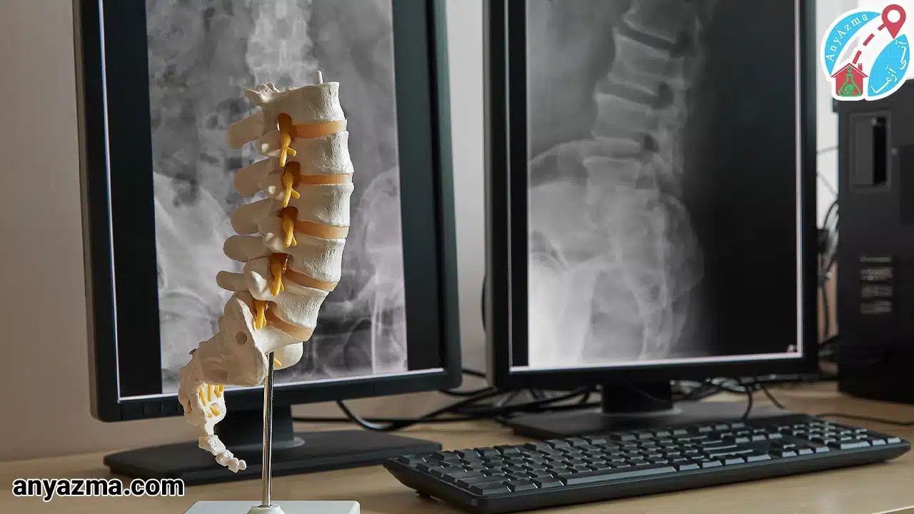 رادیولوژی کمر در منزل