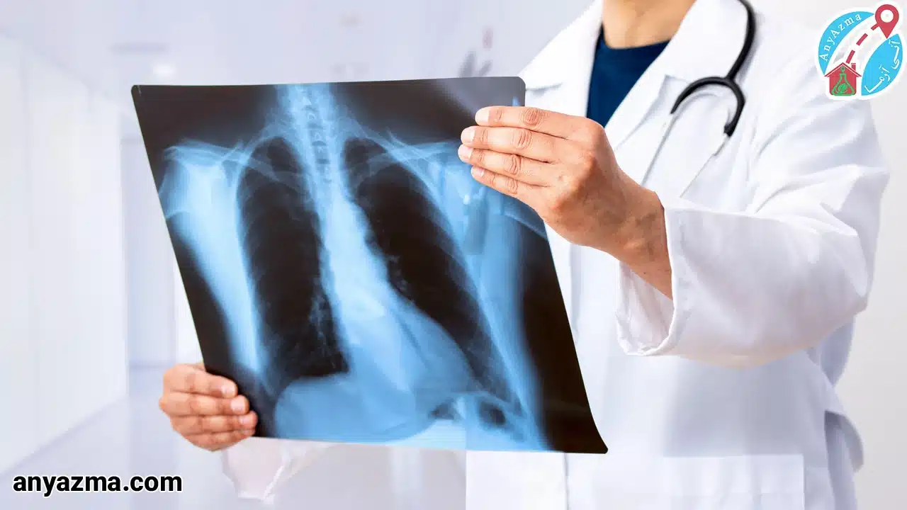 رادیوگرافی ریه در منزل