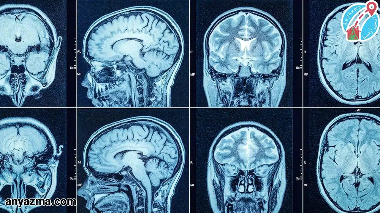 رادیولوژی سر در منزل