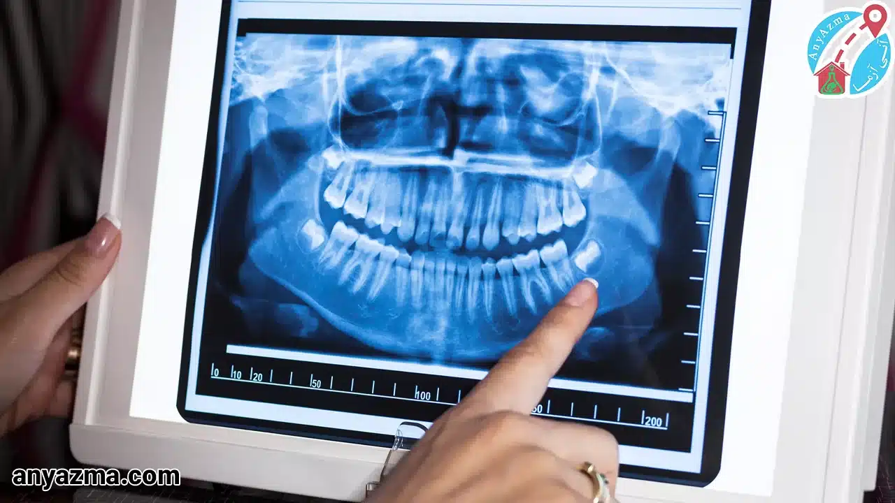 رادیولوژی فک و صورت در منزل