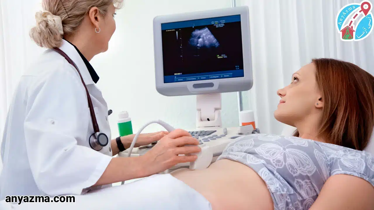 سونوگرافی مثانه در منزل