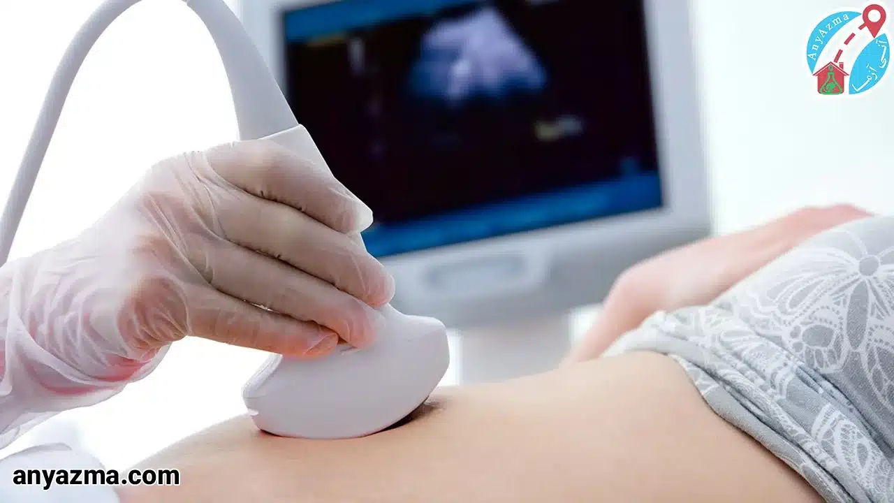 سونوگرافی در منزل اصفهان 