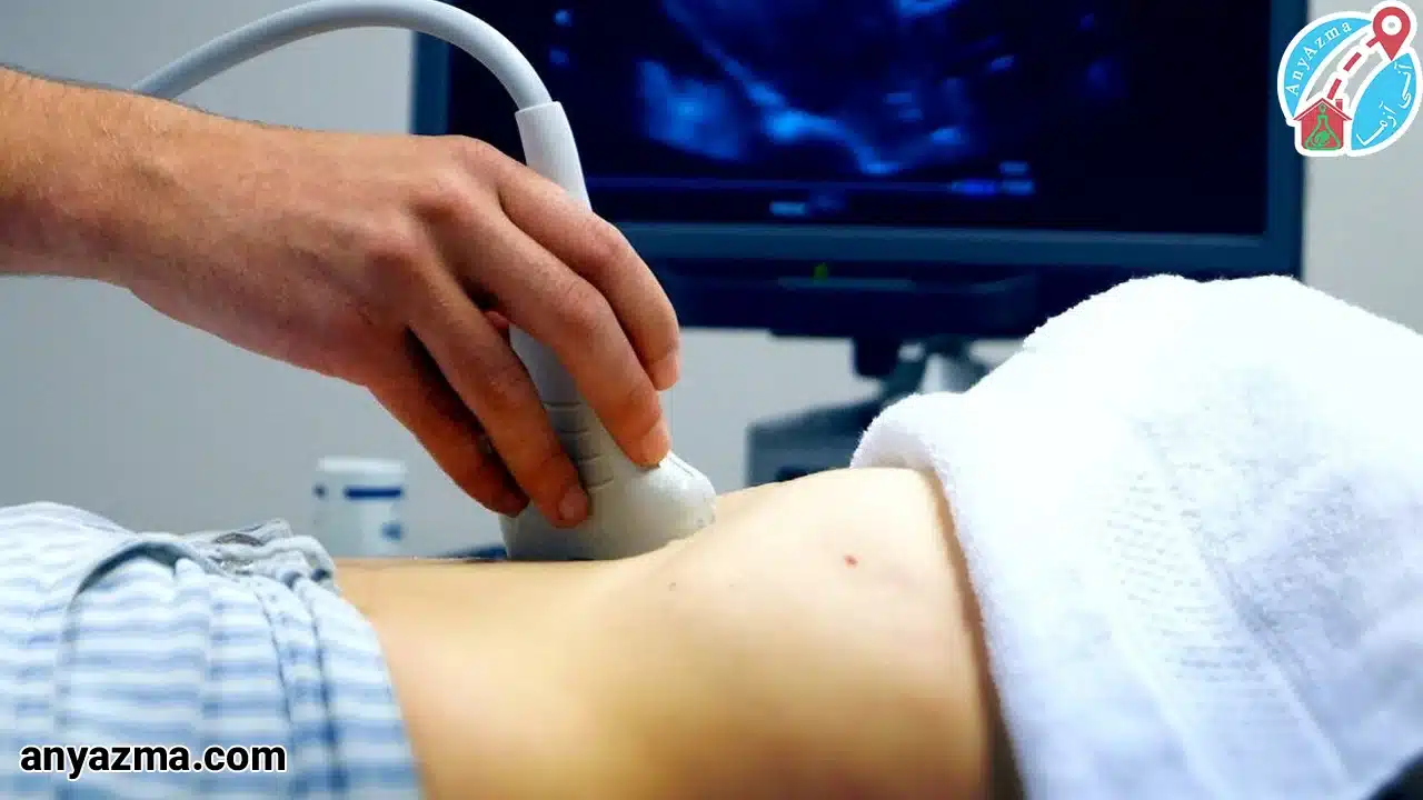 سونوگرافی در منزل تبریز