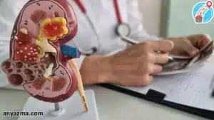 تشخیص عفونت و نارسایی کلیه با سونوگرافی